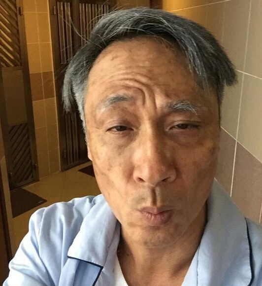 秃顶和满头白发哪个能让你心理平衡点?