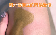 张柏芝倒立失手跌伤脚 小腿红肿直呼“痛到爆炸”