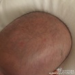 范玮琪用母乳治愈爱子头上痘痘 大呼“神奇”